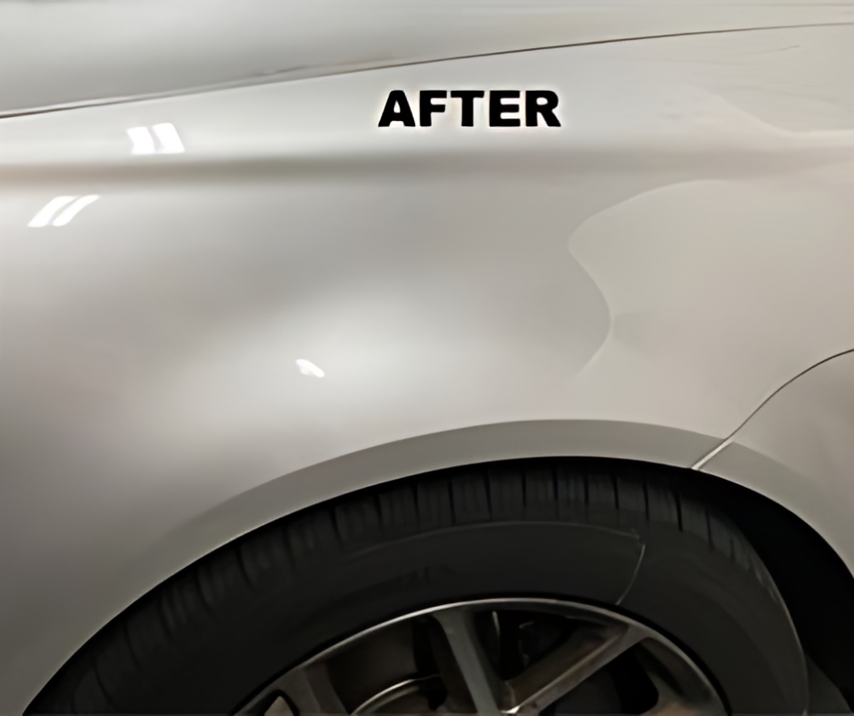 extremedent after