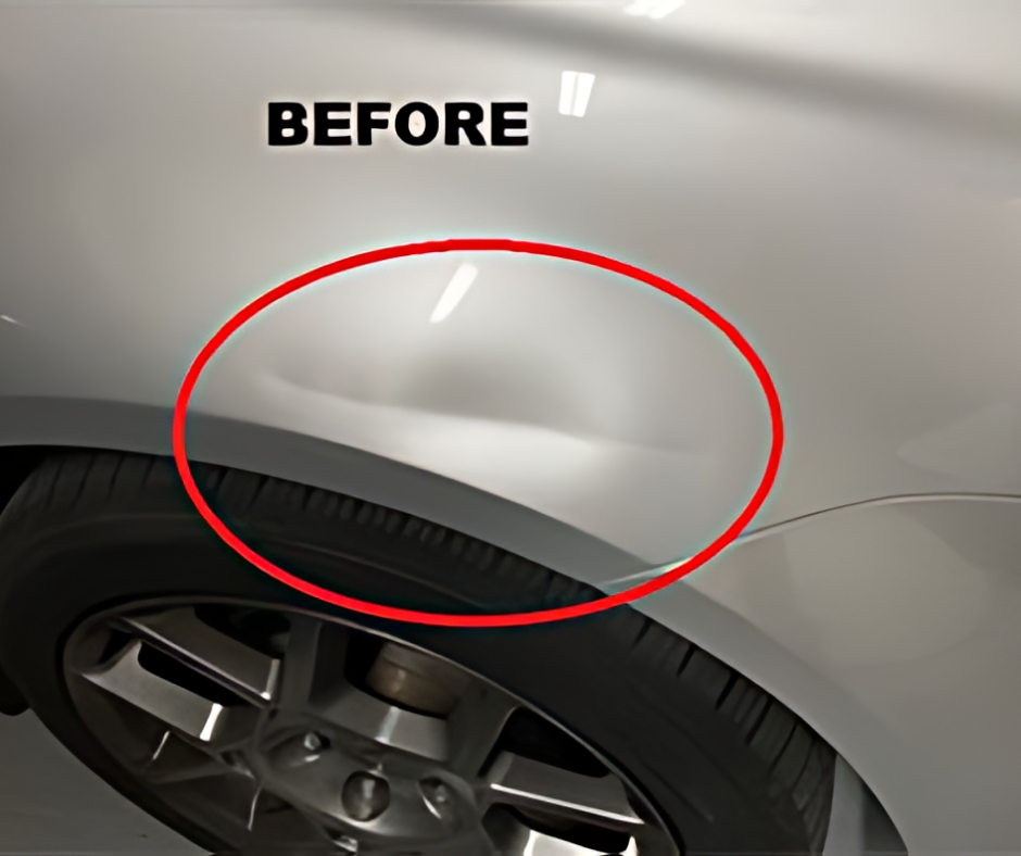extremedent before